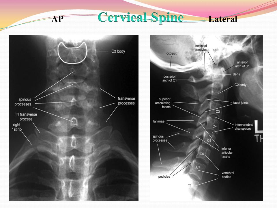 Atlas radiographic anatomy pdf torrent american horror story s03e03 kickasstorrents